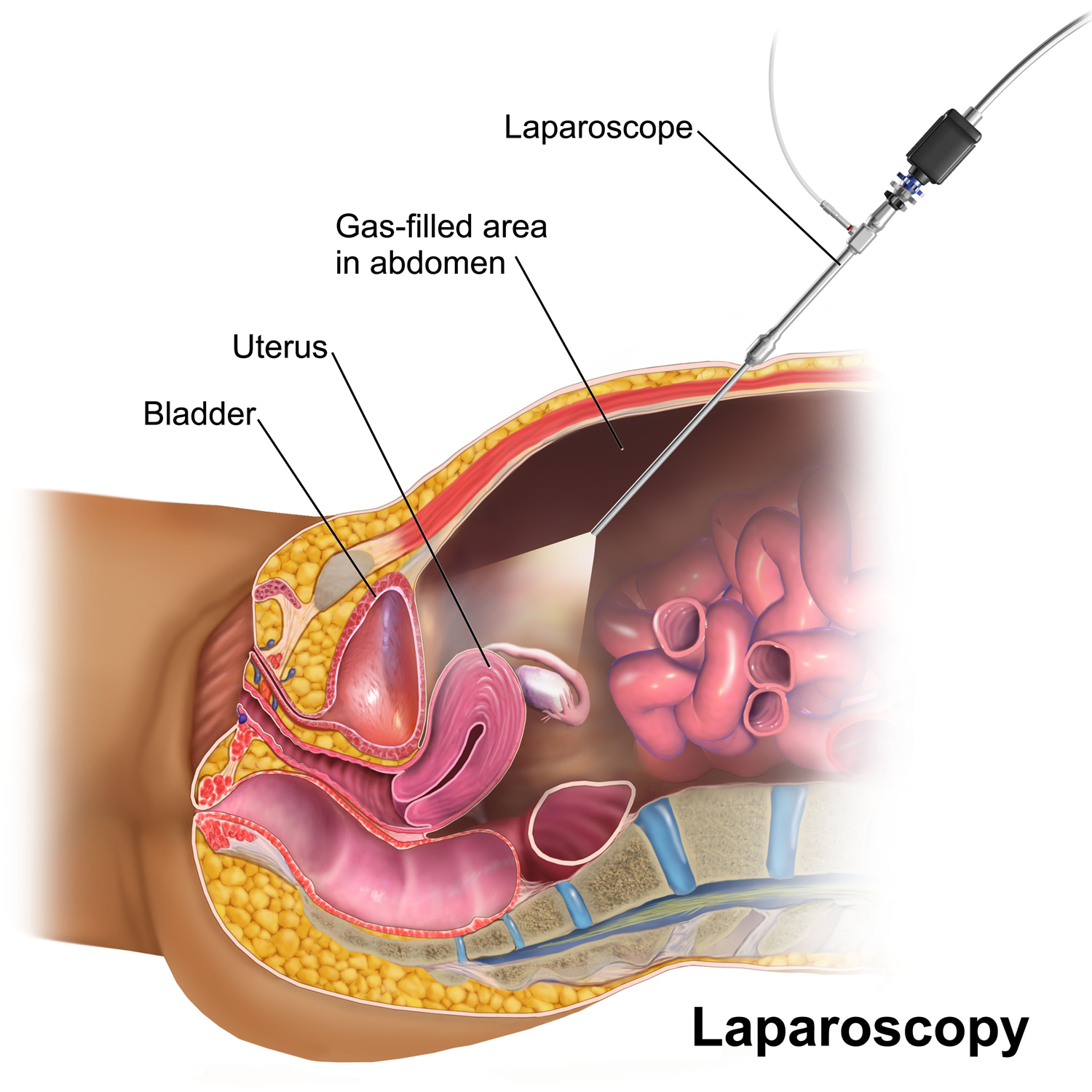 Laparoscopic Diagnostic​